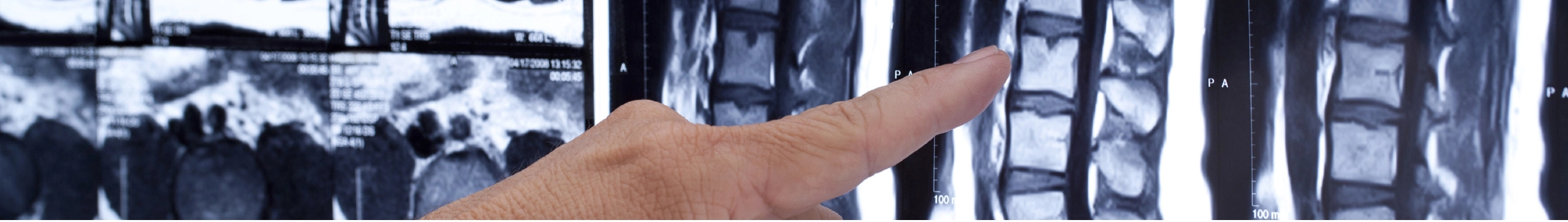 Header Spine Program