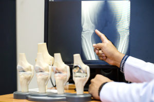 orthopedics - imaging