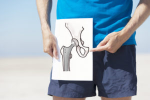 Total hip replacement