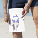 Avoid activities after total knee replacement