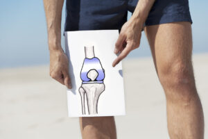 Avoid activities after total knee replacement