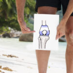 Total Knee Replacement