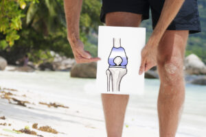Total Knee Replacement