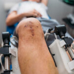 focused shot after a total joint replacement surgery on the knee