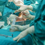 Team Orthopedic doctor during perform operation bone fracture surgery patient at the operating room in hospital. Operation medical surgery procedure.