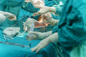 Team Orthopedic doctor during perform operation bone fracture surgery patient at the operating room in hospital. Operation medical surgery procedure.